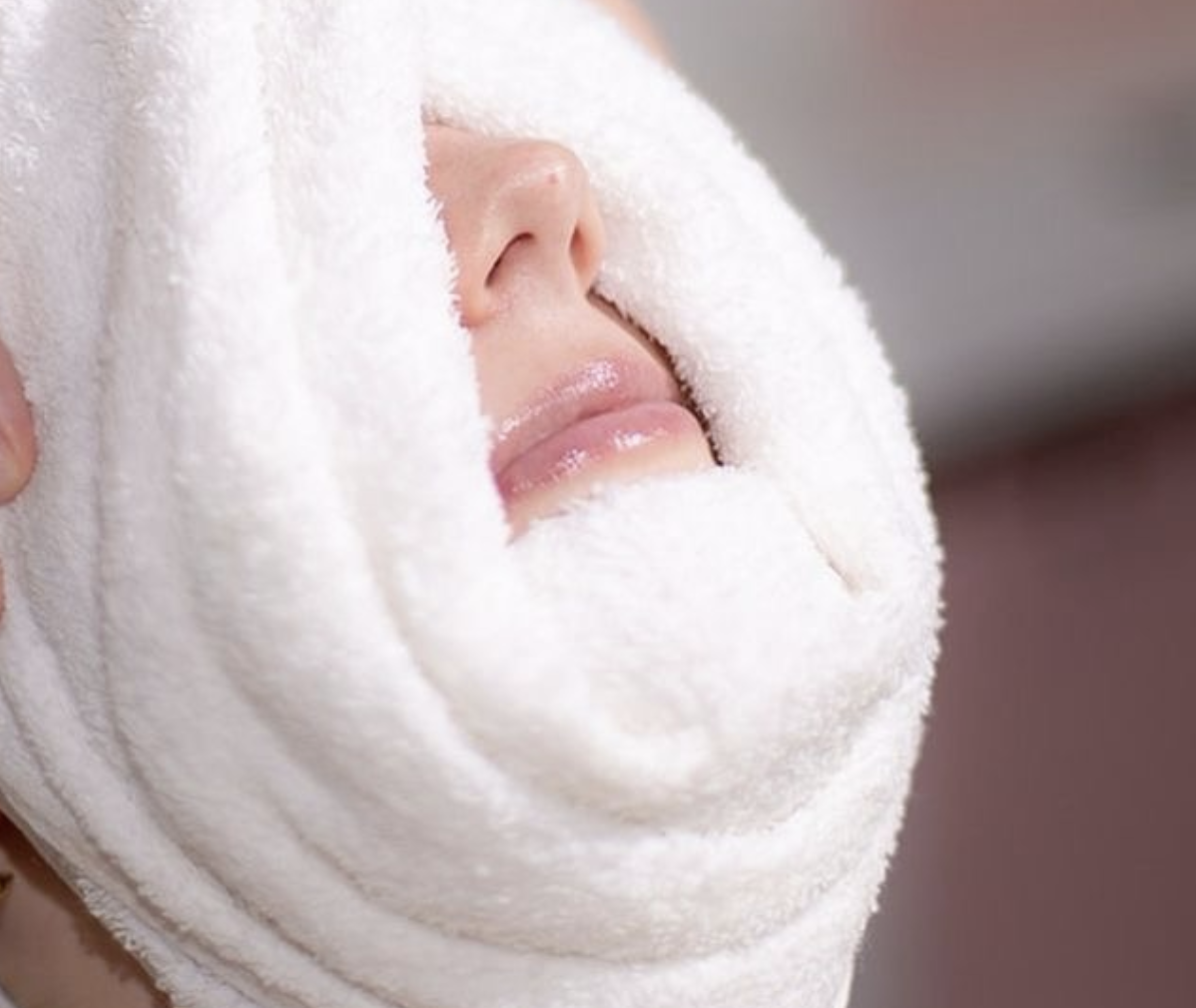 Microneedling Treatment Result 2
